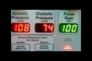 what causes low blood pressure