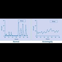 Hormonal Fluctuations