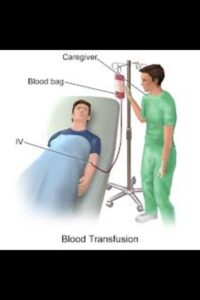 Blood Transfusions: