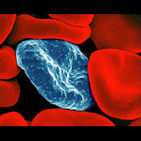 Malaria parasite attacks red blood cells:A Host’s Perspective