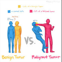 Malignant Tumors