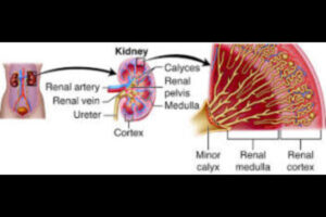 Kidney Pain 