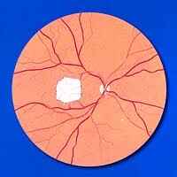 Gastrointestinal signs